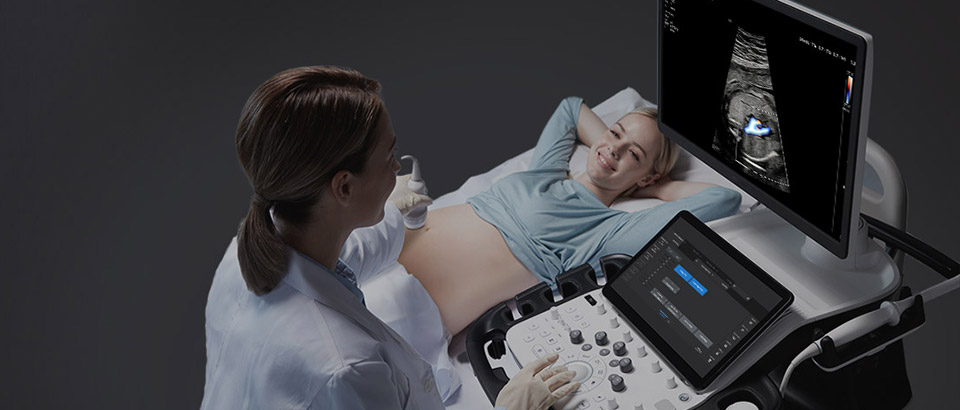 Teaser Samsung V8 Ultraschallsystem